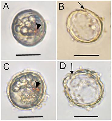 Novel Non-paralytic Shellfish Toxin and Non-spirolide Toxicity to Finfish, Brine Shrimp, and Rotifer Observed in a Culture of the Dinoflagellate Alexandrium insuetum Isolated From the Coastal Water of China